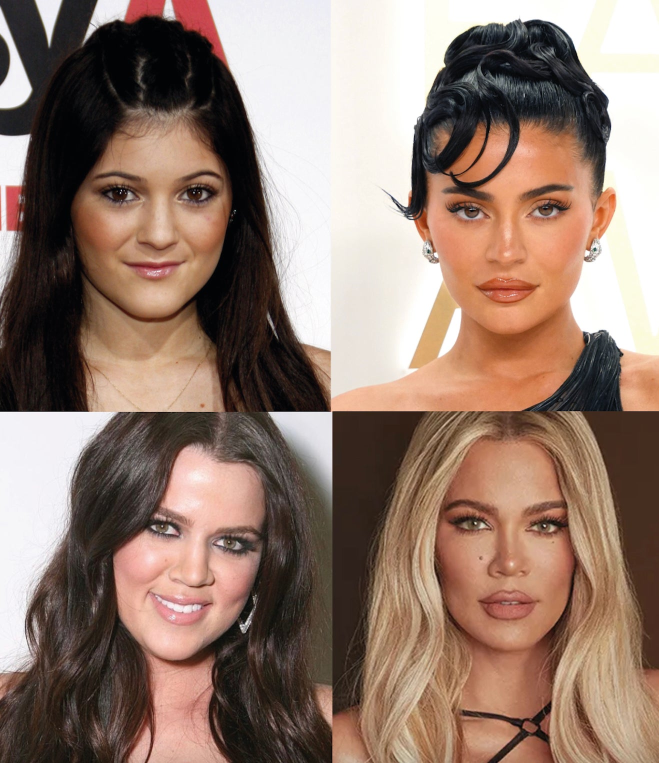 La evolución de los rostros de las Kardashian, a las que millones de personas han visto crecer a través de su reality show, (ya van 14 años de programa) son la evidencia de sus numerosos retoques estéticos, como se ve en el rostro de Kylie Jenner y Khloé Kardashian.